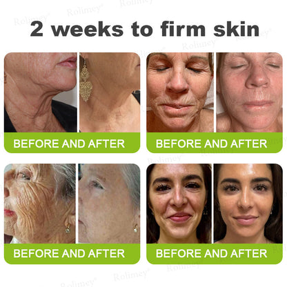 Made and shipped from the UK 🏉Rolimey® Botox & Vita-A Retinol Shot Wrinkle-Lift Tightening cream - Last Day Promotion 70% OFF