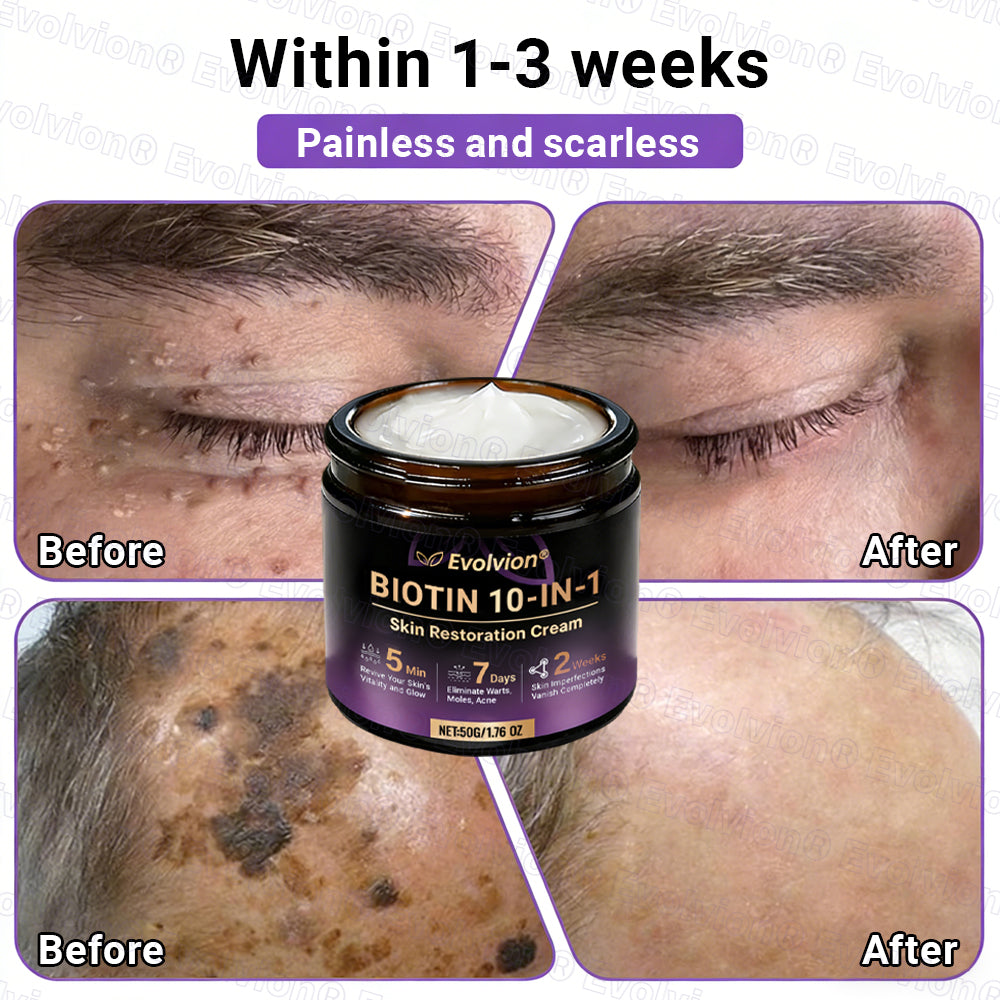 Made and Shipped from UK🏉👨‍⚕️Evolvion® Biotin 10-in-1 All-in-One Barrier Repair Cream - Last Day Promotion: 50% OFF