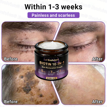 Made and Shipped from UK🏉👨‍⚕️Evolvion® Biotin 10-in-1 All-in-One Barrier Repair Cream - Last Day Promotion: 50% OFF