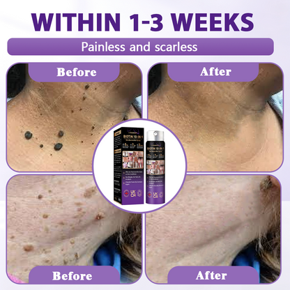 Made and shipped from the United Kingdom ✨Evolvion® 🏈Biotin 10-in-1 Skin Restoration Spray✨✨