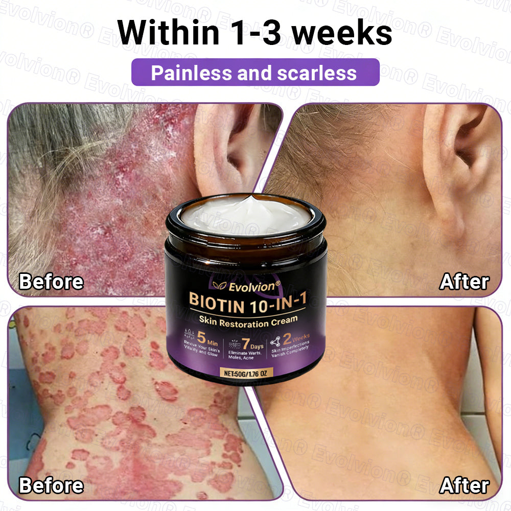 Made and Shipped from UK🏉👨‍⚕️Evolvion® Biotin 10-in-1 All-in-One Barrier Repair Cream - Last Day Promotion: 50% OFF