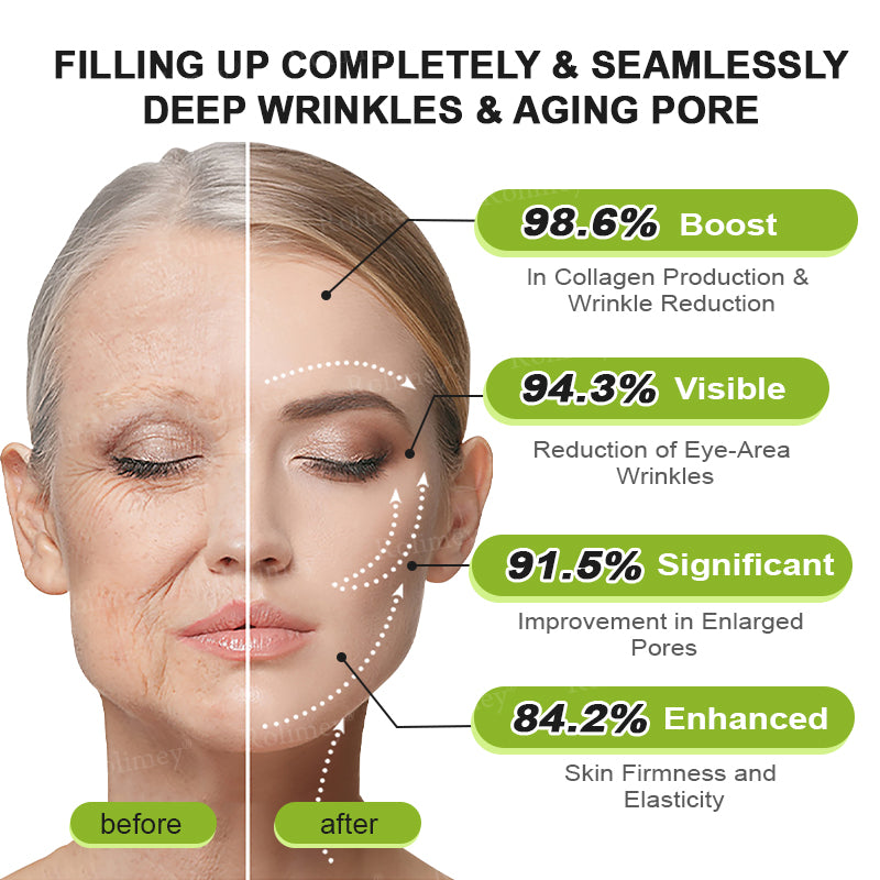 Made and shipped from the UK 🏉Rolimey® Botox & Vita-A Retinol Shot Wrinkle-Lift Tightening cream - Last Day Promotion 70% OFF