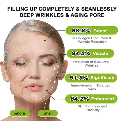 Made and shipped from the UK 🏉Rolimey® Botox & Vita-A Retinol Shot Wrinkle-Lift Tightening cream - Last Day Promotion 70% OFF