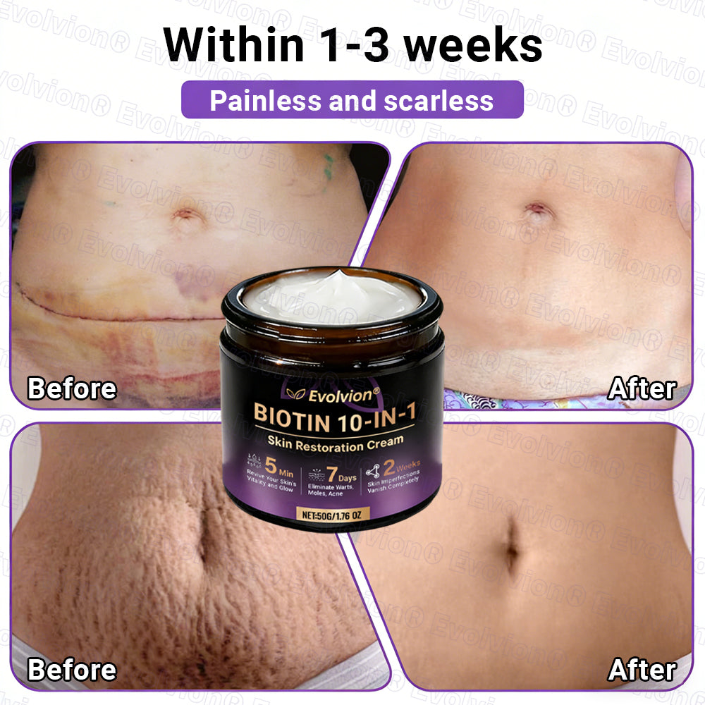 Made and Shipped from UK🏉👨‍⚕️Evolvion® Biotin 10-in-1 All-in-One Barrier Repair Cream - Last Day Promotion: 50% OFF