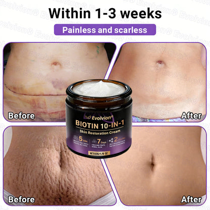 Made and Shipped from UK🏉👨‍⚕️Evolvion® Biotin 10-in-1 All-in-One Barrier Repair Cream - Last Day Promotion: 50% OFF