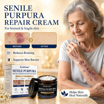 🏉Evolvion® Senile Purpura, Bruise & Fragile Skin Repair Cream💛
