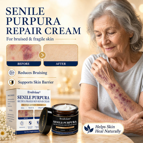 🏉Evolvion® Senile Purpura, Bruise & Fragile Skin Repair Cream💛