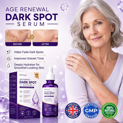 🏉✅Rolimey® Age Renewal Dark Spot Serum — Infused with 10% Niacinamide, Tranexamic Acid & Hyaluronic Acid for Brighter, Smoother-Looking Mature Skin