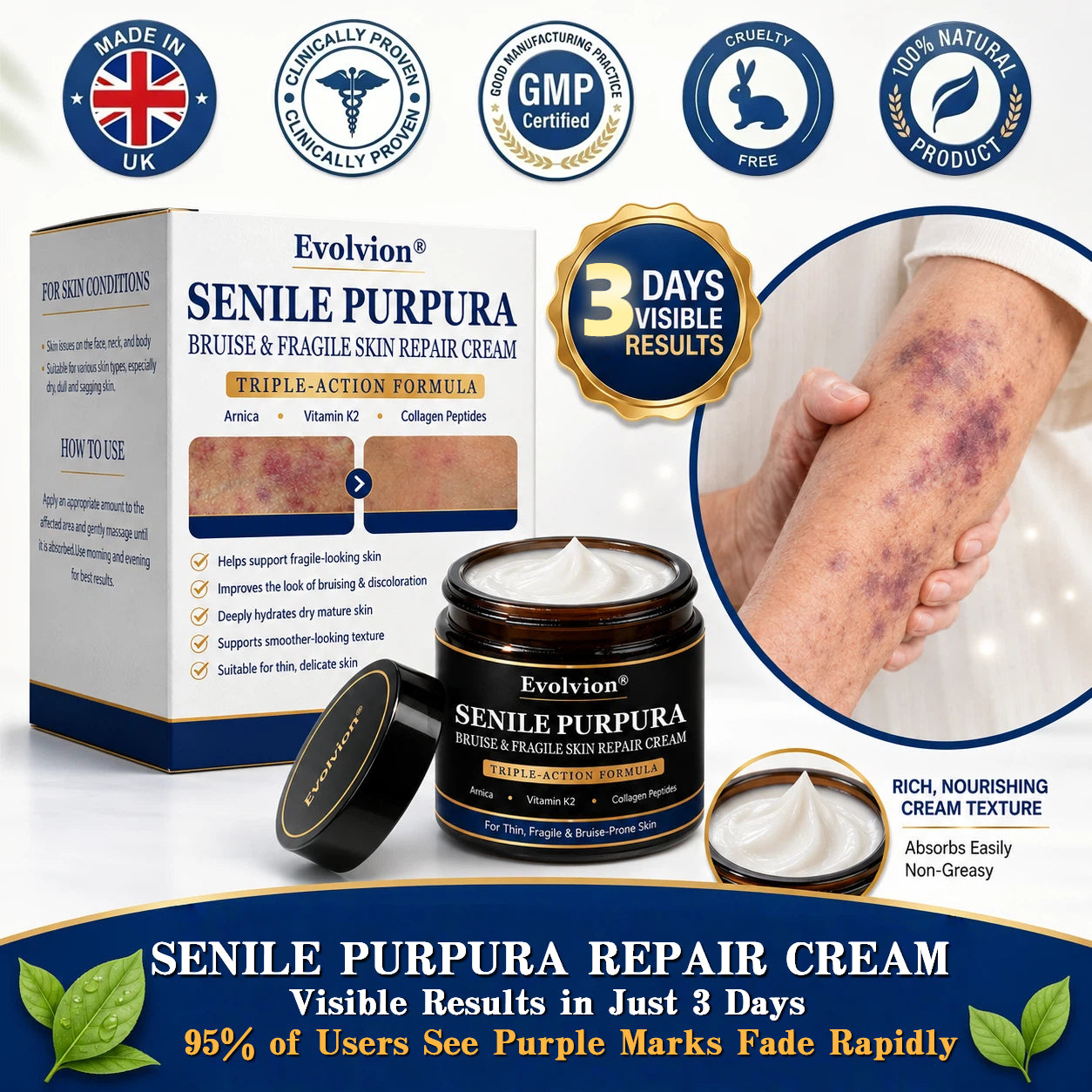 🔥75K+ SOLD🏉👨‍⚕️Evolvion® Senile Purpura, Bruise & Fragile Skin Repair Cream💛