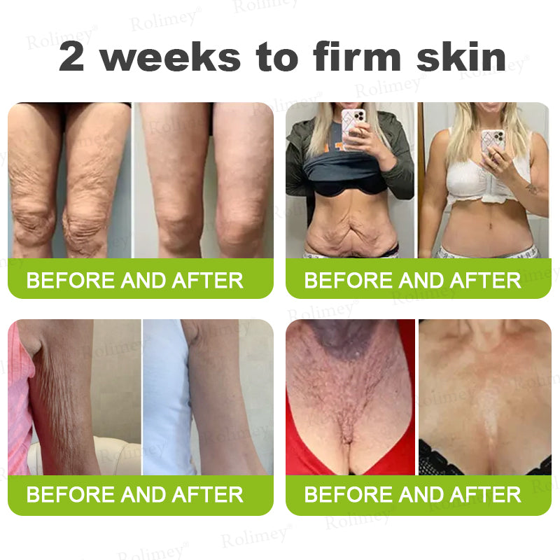 Made and shipped from the UK 🏉Rolimey® Botox & Vita-A Retinol Shot Wrinkle-Lift Tightening cream - Last Day Promotion 70% OFF