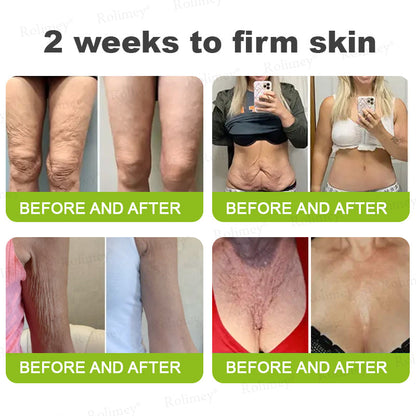 Made and shipped from the UK 🏉Rolimey® Botox & Vita-A Retinol Shot Wrinkle-Lift Tightening cream - Last Day Promotion 70% OFF
