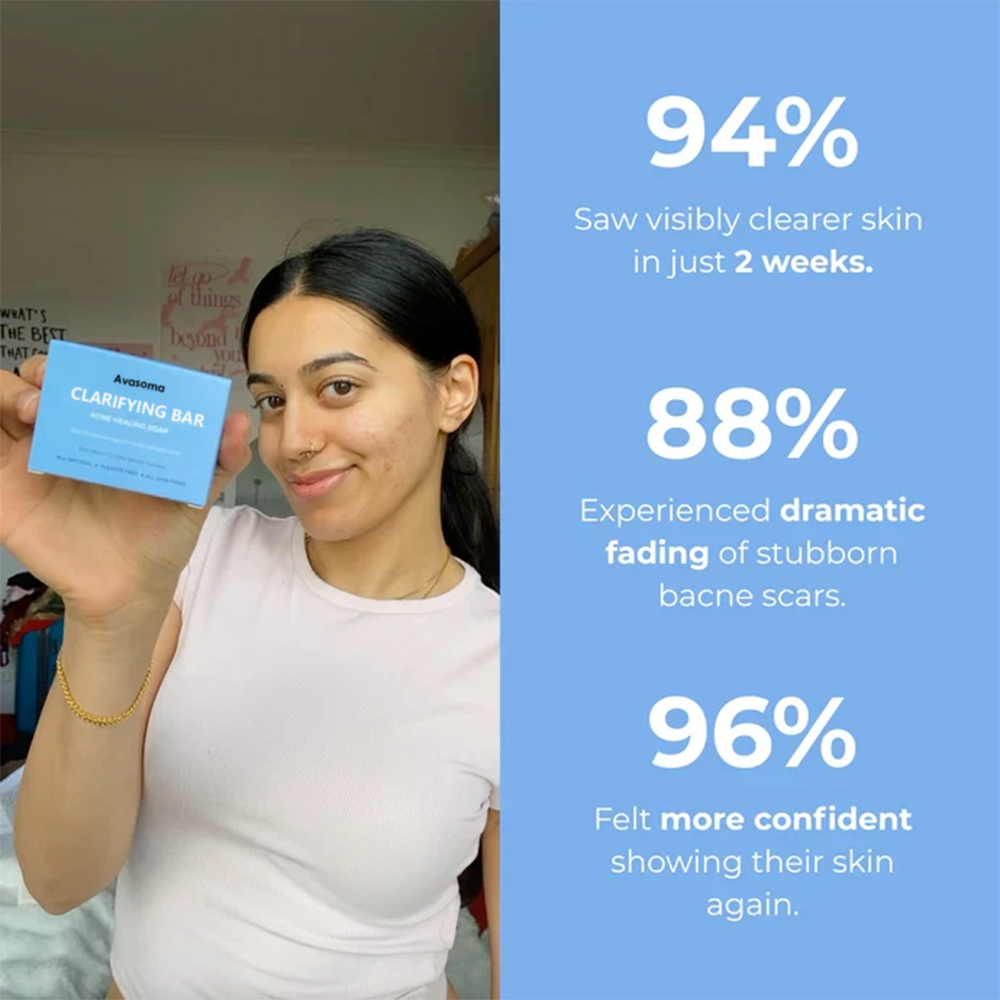 🌿 Avasoma® Natural Botanical Treatment Bar | Advanced Acne & Scar Remover for Back & Body ✨