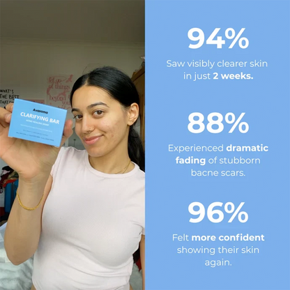🌿 Avasoma® Natural Botanical Treatment Bar | Advanced Acne & Scar Remover for Back & Body ✨
