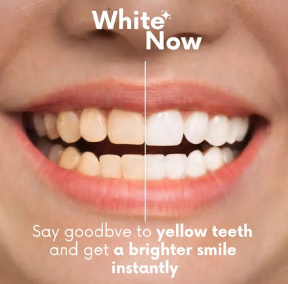 🧍‍♂️Avasoma® |  Tooth Polishing Whitener - A White Smile Without Treatments
