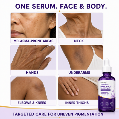 🐬Rolimey® Advanced Targeted Serum for Stubborn Pigmentation