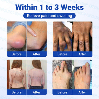 𝐎𝐟𝐟𝐢𝐜𝐢𝐚𝐥 𝐒𝐭𝐨𝐫𝐞 🇬🇧 |🏉GFOUK® BPC-157 × NSAID 10-in-1 Penetrating Greaseless Arthritis Gel