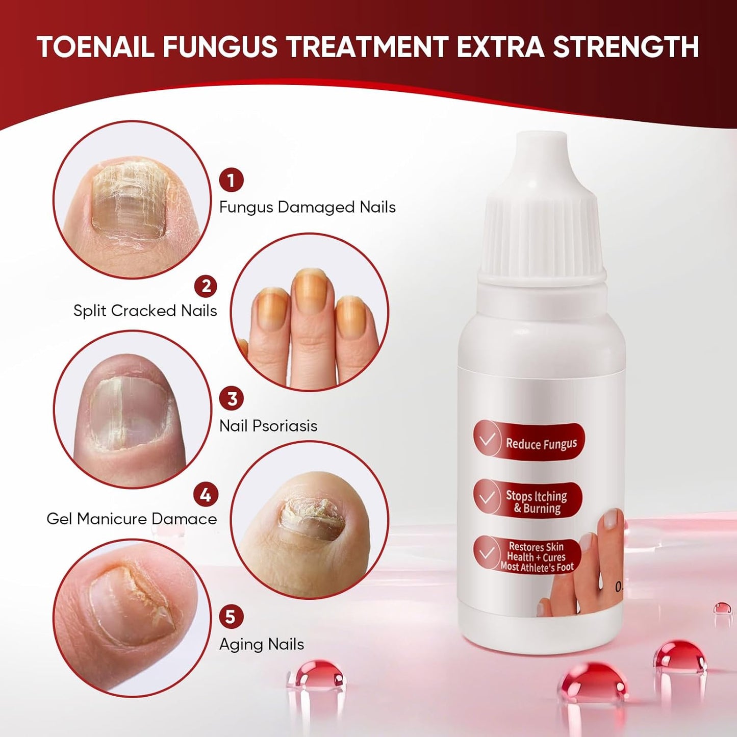 🌿 Avasoma® Natural 🌿💧 Herbal Toenail Fungus Relief Drops - Fast Itch & Burning Relief for Foot Care 🛡️