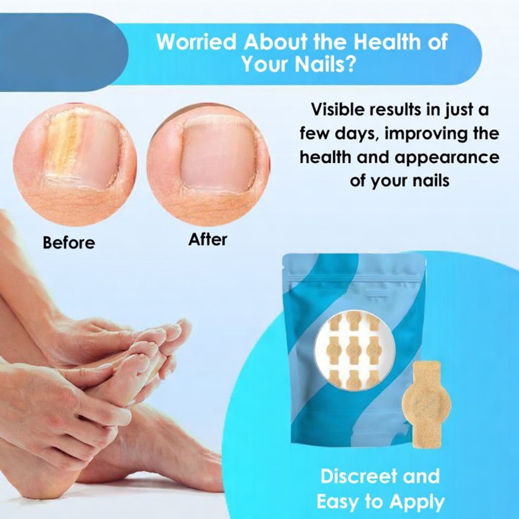 Fungal Nail Patches, 21pcs/box Nail Health Care Patches, Nail Fungus Care Patches, Suitable for Solving Fungal Nails and Other Nail Problems, Nail Supplies, Daily Care Nails Kit Set