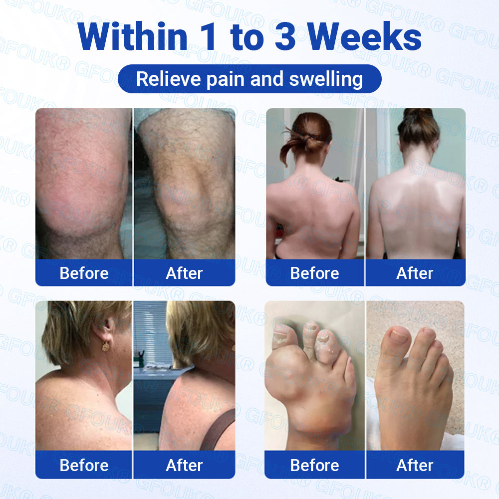 𝐎𝐟𝐟𝐢𝐜𝐢𝐚𝐥 𝐒𝐭𝐨𝐫𝐞 🇬🇧 |🏉GFOUK® BPC-157 × NSAID 10-in-1 Penetrating Greaseless Arthritis Gel