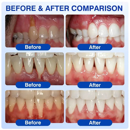 Pheromex® ❤️❤️❤️❤️GumRevive Periodontal Care Gel