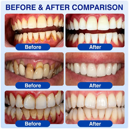 Pheromex® ❤️❤️❤️❤️GumRevive Periodontal Care Gel