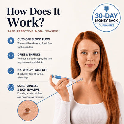 GFOUK®Skintag Removal Kit