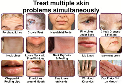 #1 Bestselling🏆--Rolimey® Calcium Multi Balm🏉Anti-Aging & Firming Skincare Stick🔥- Last Day Promotion 50% OFF