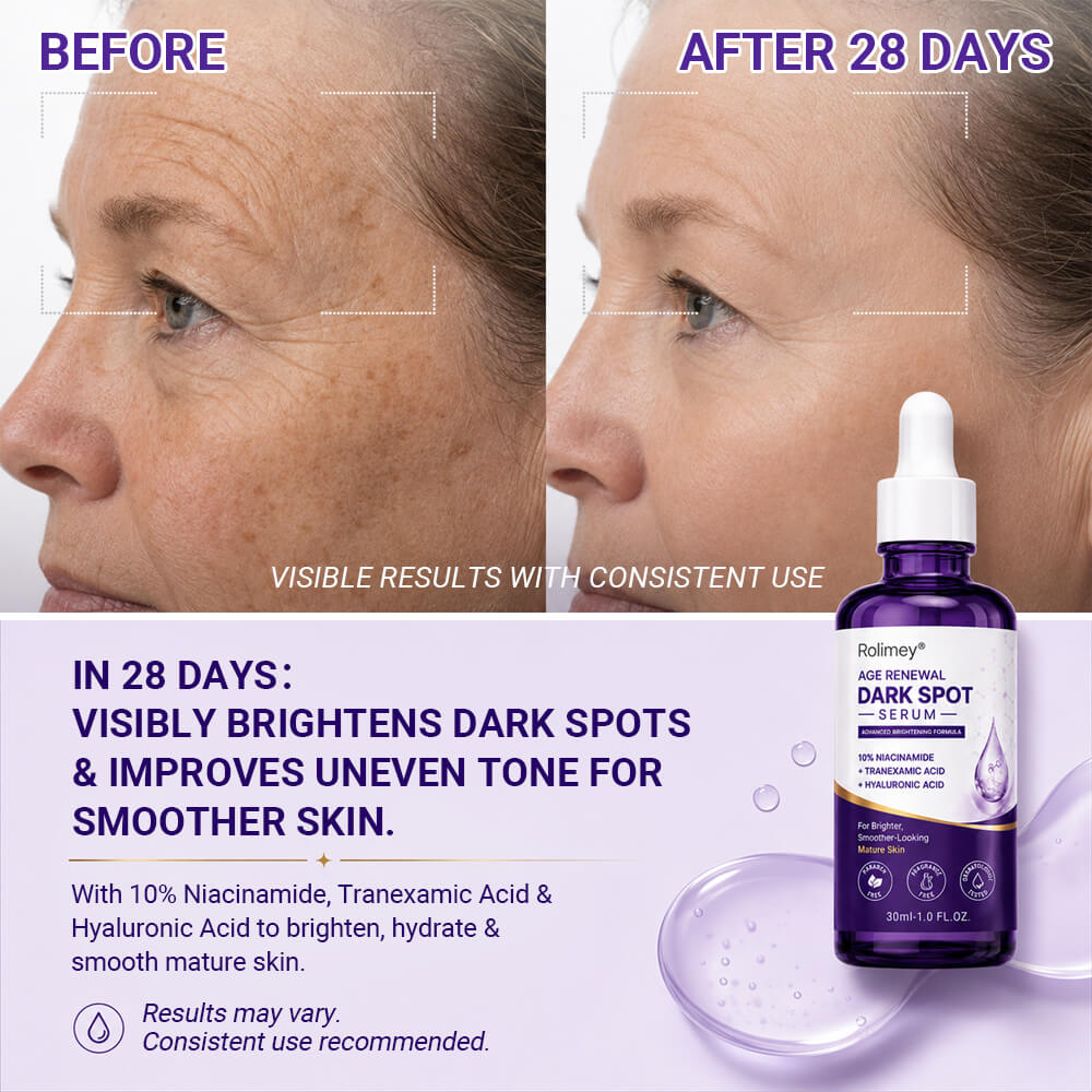 🏉✅Rolimey® Age Renewal Dark Spot Serum — Infused with 10% Niacinamide, Tranexamic Acid & Hyaluronic Acid for Brighter, Smoother-Looking Mature Skin