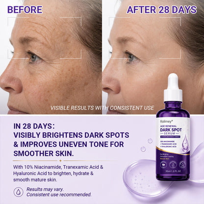 🏉✅Rolimey® Age Renewal Dark Spot Serum — Infused with 10% Niacinamide, Tranexamic Acid & Hyaluronic Acid for Brighter, Smoother-Looking Mature Skin