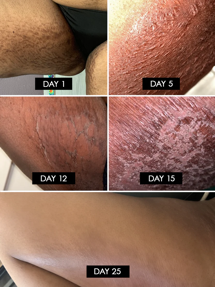 Avasoma® Restorative Body Peeling: Regain Your Skin’s Smoothness and Your Confidence