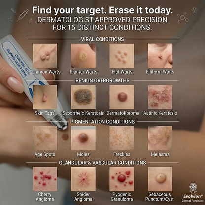 Made and Shipped from UK ✨Evolvion® 𝟕-𝐃𝒂𝘆 𝐒𝗸𝐢𝐧 𝐓𝒂𝗴 & 𝐒𝐩𝙤𝐭 𝐄𝐫𝒂𝐬𝙚𝐫 Painless & Scar-Free Advanced Imperfection Remova𝗜 Ro𝗜𝗜erba𝗜𝗜 Pen ❤️