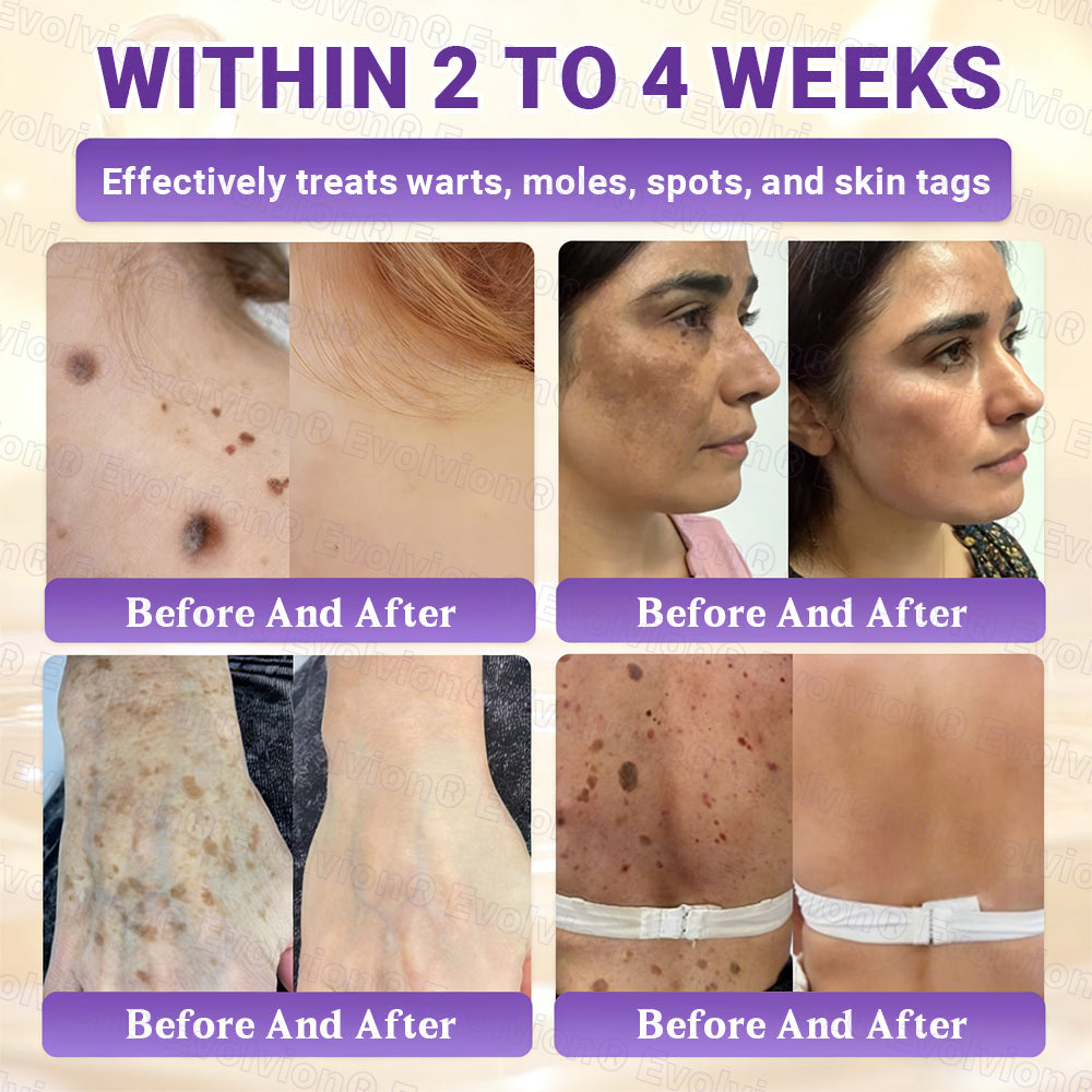 Made and Shipped from UK🏉👨‍⚕️Evolvion® Biotin 10-in-1 All-in-One Barrier Repair Cream - Last Day Promotion: 50% OFF