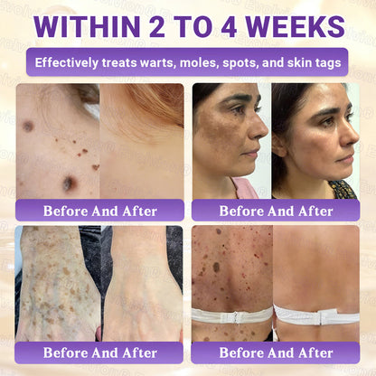 Made and Shipped from UK🏉👨‍⚕️Evolvion® Biotin 10-in-1 All-in-One Barrier Repair Cream - Last Day Promotion: 50% OFF