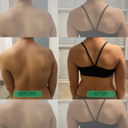 🧍‍♂️Avasoma® | Professional Posture Corrector.Discreetly invisible under clothes for lasting spinal health. Start standing better! 💎💪