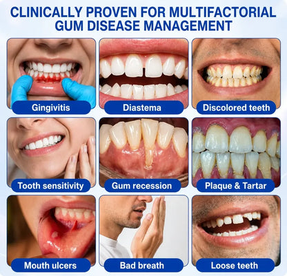 Pheromex® ❤️❤️❤️❤️GumRevive Periodontal Care Gel