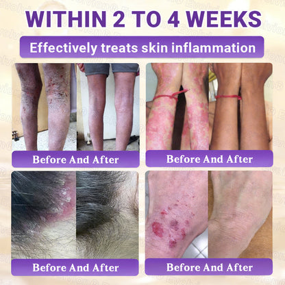 Made and Shipped from UK🏉👨‍⚕️Evolvion® Biotin 10-in-1 All-in-One Barrier Repair Cream - Last Day Promotion: 50% OFF