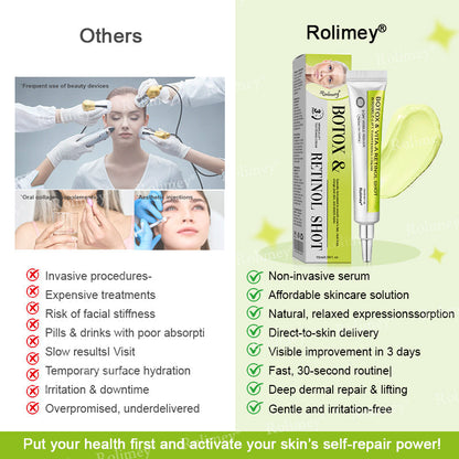 Made and shipped from the UK 🏉Rolimey® Botox & Vita-A Retinol Shot Wrinkle-Lift Tightening cream - Last Day Promotion 70% OFF