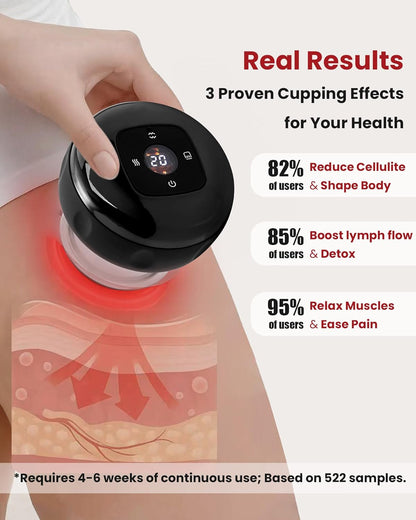 🛡️Avasoma® Smart Cupping Therapy Device: Professional AI-Powered Pain Relief, Deep Tissue Massage & Red Light Therapy for Muscle Recovery