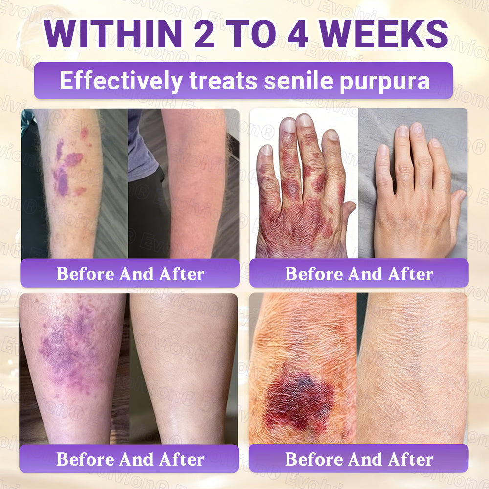 Made and Shipped from UK🏉👨‍⚕️Evolvion® Biotin 10-in-1 All-in-One Barrier Repair Cream - Last Day Promotion: 50% OFF