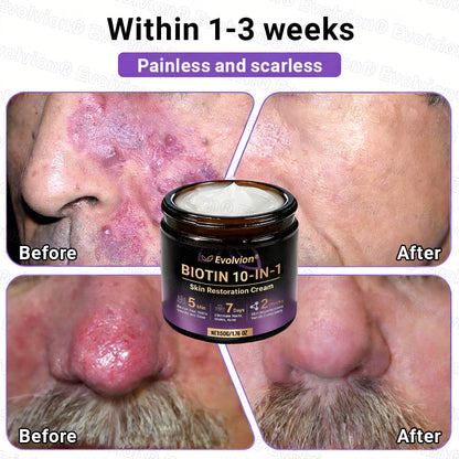 Made and Shipped from UK🏉👨‍⚕️Evolvion® Biotin 10-in-1 All-in-One Barrier Repair Cream - Last Day Promotion: 50% OFF
