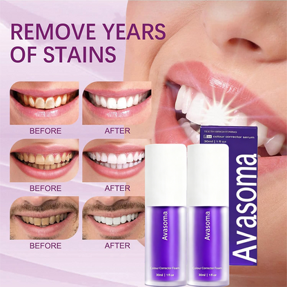 🦷Avasoma® Teeth V34 Color Corrector Serum | 30s Yellow Neutralizer & Zero Sensitivity Care