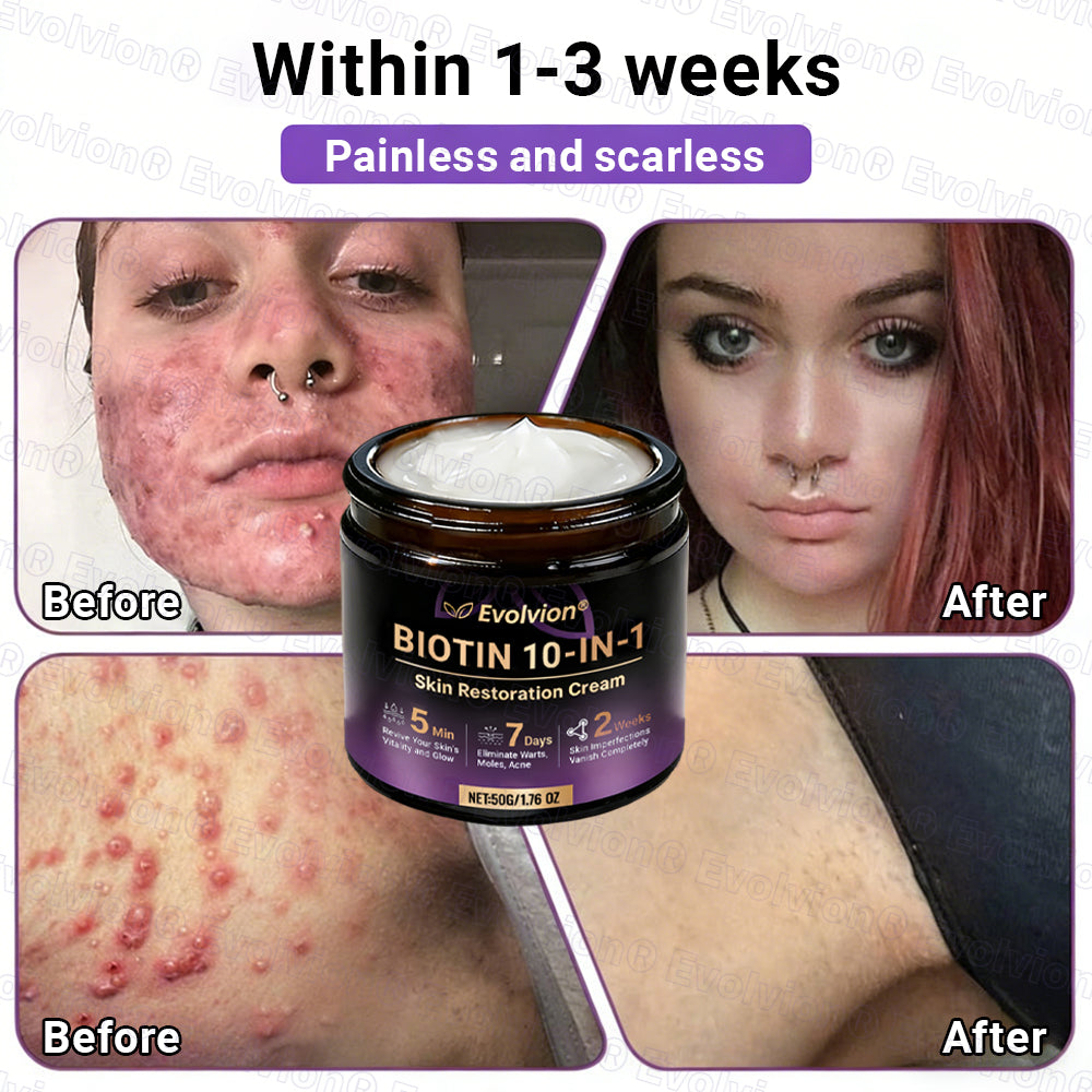 Made and Shipped from UK🏉👨‍⚕️Evolvion® Biotin 10-in-1 All-in-One Barrier Repair Cream - Last Day Promotion: 50% OFF