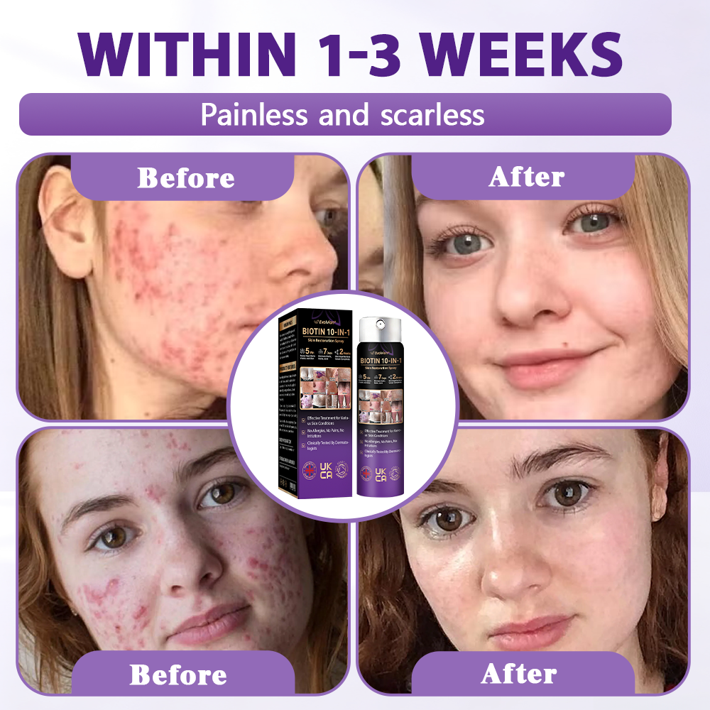 Made and shipped from the United Kingdom ✨Evolvion® ➕➕❤Biotin 10-in-1 Skin Restoration Spray✨✨