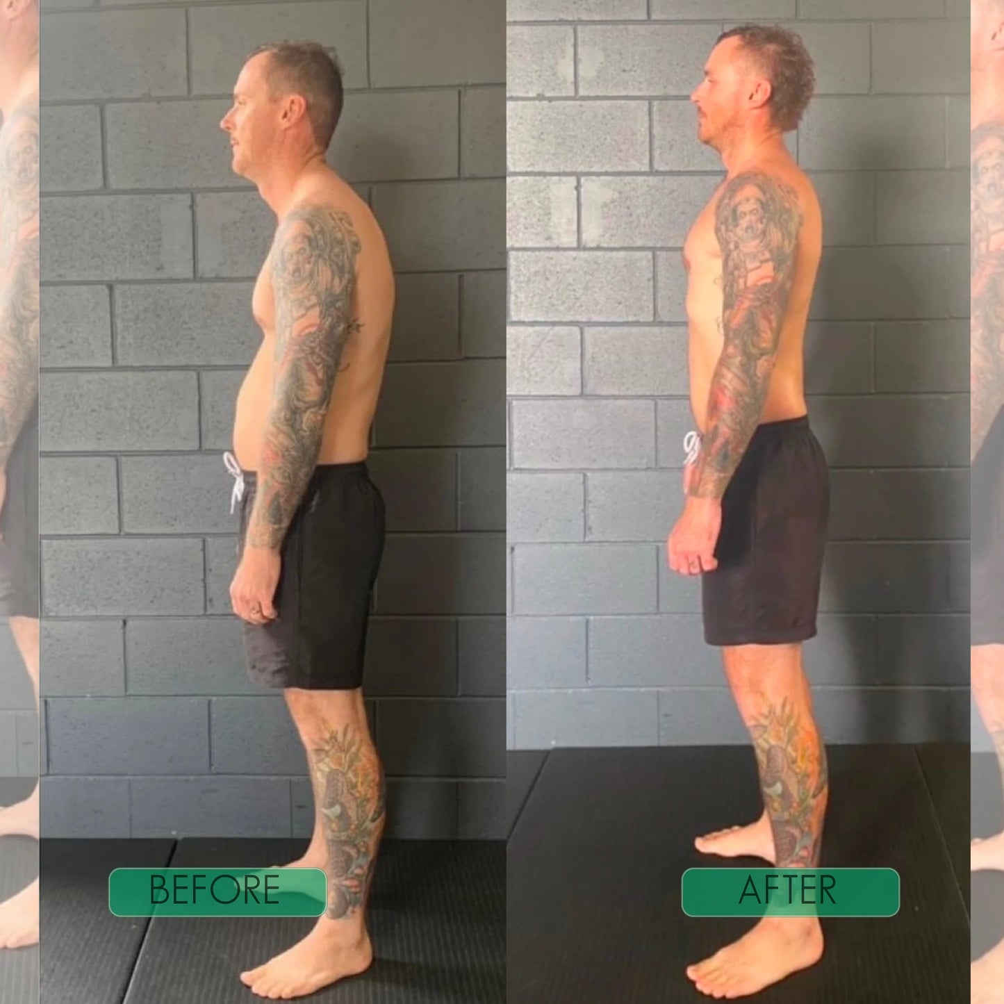 🧍‍♂️Avasoma® | Professional Posture Corrector.Discreetly invisible under clothes for lasting spinal health. Start standing better! 💎💪