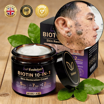 Made and Shipped from UK🏉👨‍⚕️Evolvion® Biotin 10-in-1 All-in-One Barrier Repair Cream - Last Day Promotion: 50% OFF