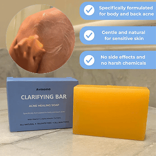 🌿 Avasoma® Natural Botanical Treatment Bar | Advanced Acne & Scar Remover for Back & Body ✨