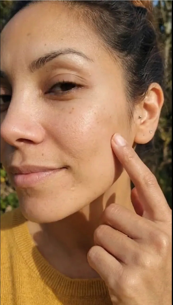 User-supplied facial pigmentation image after comparison